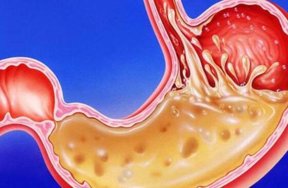 Why won’t gastric juice dissolve our body?